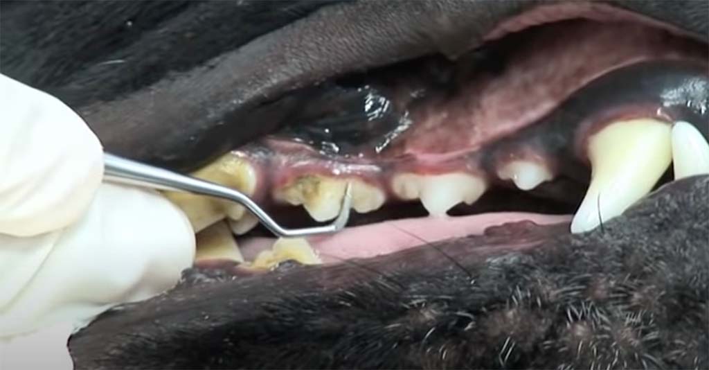 Cleaning under the gum line using curettes.