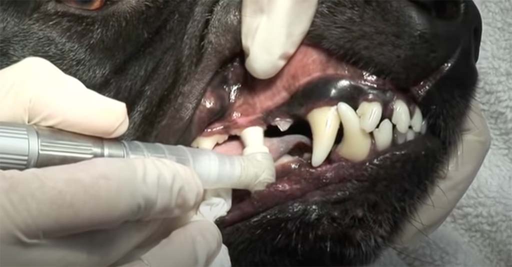 Polishing the teeth to remove stains from the surface of each tooth.